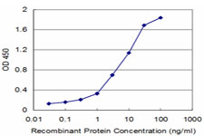 UMPS / OPRT Antibody - Detection limit for recombinant GST tagged UMPS is approximately 0.1 ng/ml as a capture antibody.