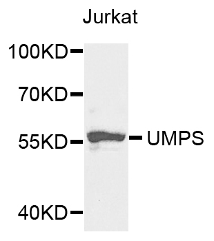 UMPS / OPRT Antibody - Western blot analysis of extracts of Jurkat cells.