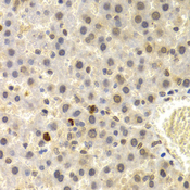 UMPS / OPRT Antibody - Immunohistochemistry of paraffin-embedded rat liver tissue.