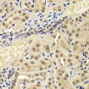 UMPS / OPRT Antibody - Immunohistochemistry of paraffin-embedded mouse kidney tissue.