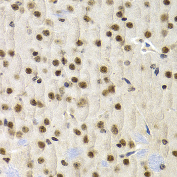 UMPS / OPRT Antibody - Immunohistochemistry of paraffin-embedded mouse brain tissue.