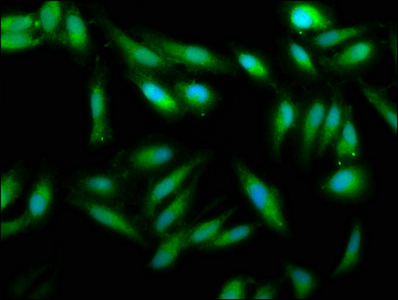 UMPS / OPRT Antibody - Immunofluorescence staining of Hela cells at a dilution of 1:33, counter-stained with DAPI. The cells were fixed in 4% formaldehyde, permeabilized using 0.2% Triton X-100 and blocked in 10% normal Goat Serum. The cells were then incubated with the antibody overnight at 4 °C.The secondary antibody was Alexa Fluor 488-congugated AffiniPure Goat Anti-Rabbit IgG (H+L) .