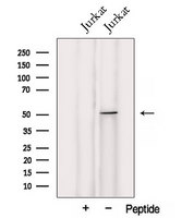 UMPS / OPRT Antibody - Western blot analysis of extracts of Jurkat cells using UMPS antibody. The lane on the left was treated with blocking peptide.