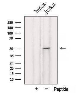 UMPS / OPRT Antibody - Western blot analysis of extracts of Jurkat cells using UMPS antibody. The lane on the left was treated with blocking peptide.