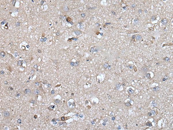 UMPS / OPRT Antibody - Immunohistochemistry of paraffin-embedded Human brain tissue  using UMPS Polyclonal Antibody at dilution of 1:40(×200)