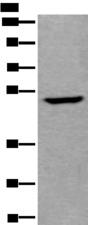 UMPS / OPRT Antibody - Western blot analysis of Human fetal liver tissue lysate  using UMPS Polyclonal Antibody at dilution of 1:400