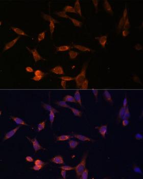 UMPS / OPRT Antibody - Immunofluorescence analysis of NIH/3T3 cells using UMPS Polyclonal Antibody at dilution of 1:100 (40x lens).Blue: DAPI for nuclear staining.