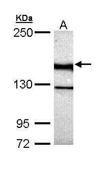 UNC13B Antibody - Sample (30 ug of whole cell lysate). A: Hela. 5% SDS PAGE. UNC13B / MUNC13 antibody diluted at 1:5000.