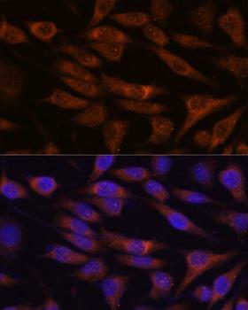 UNC13B Antibody - Immunofluorescence analysis of L929 cells using UNC13B Polyclonal Antibody at dilution of 1:100.Blue: DAPI for nuclear staining.