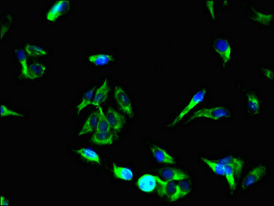 UNC13C Antibody - Immunofluorescent analysis of Hela cells using UNC13C Antibody at dilution of 1:100 and Alexa Fluor 488-congugated AffiniPure Goat Anti-Rabbit IgG(H+L)
