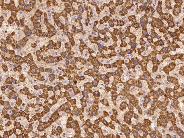 UNC13C Antibody - Immunochemical staining of human UNC13C in human liver with rabbit polyclonal antibody at 1:100 dilution, formalin-fixed paraffin embedded sections.