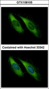 UNC13D Antibody - Immunofluorescence of methanol-fixed HeLa using Munc 13-4 antibody at 1:500 dilution.