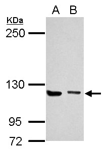 UNC13D Antibody - Sample (30 ug of whole cell lysate). A: Jurkat, B: K562. 5% SDS PAGE. UNC13D / MUNC13-4 antibody diluted at 1:1000.