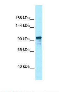 UNC13D Antibody - Western blot of Human Fetal Lung . UNC13D antibody dilution 1.0 ug/ml.  This image was taken for the unconjugated form of this product. Other forms have not been tested.