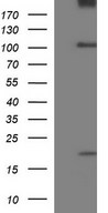 UNC13D Antibody - HEK293T cells were transfected with the pCMV6-ENTRY control (Left lane) or pCMV6-ENTRY UNC13D (Right lane) cDNA for 48 hrs and lysed. Equivalent amounts of cell lysates (5 ug per lane) were separated by SDS-PAGE and immunoblotted with anti-UNC13D.