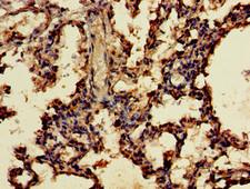 UNC13D Antibody - Immunohistochemistry of paraffin-embedded human lung tissue using UNC13D Antibody at dilution of 1:100