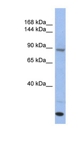 UNC45A Antibody - UNC45A antibody Western blot of Fetal Thymus lysate. This image was taken for the unconjugated form of this product. Other forms have not been tested.