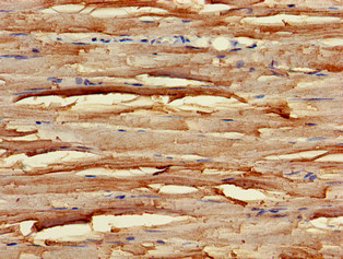 UNC45B Antibody - Immunohistochemistry of paraffin-embedded human skeletal muscle tissue using UNC45B Antibody at dilution of 1:100