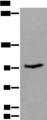 UNC45B Antibody - Western blot analysis of Mouse skeletal muscle tissue lysate  using UNC45B Polyclonal Antibody at dilution of 1:600