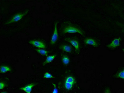 UNC50 Antibody - Immunofluorescent analysis of A549 cells using UNC50 Antibody at dilution of 1:100 and Alexa Fluor 488-congugated AffiniPure Goat Anti-Rabbit IgG(H+L)