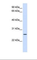 UNC50 Antibody - Fetal liver lysate. Antibody concentration: 1.0 ug/ml. Gel concentration: 12%.  This image was taken for the unconjugated form of this product. Other forms have not been tested.
