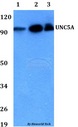 UNC5A Antibody - Western blot of UNC5A antibody at 1:500 dilution. Lane 1: HEK293T whole cell lysate. Lane 2: Raw264.7 whole cell lysate. Lane 3: PC12 whole cell lysate.