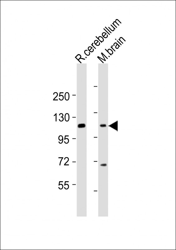UNC5H2 / UNC5B Antibody - All lanes : Anti-UNC5B Antibody at 1:2000 dilution Lane 1: rat cerebellum lysates Lane 2: mouse brain lysates Lysates/proteins at 20 ug per lane. Secondary Goat Anti-Rabbit IgG, (H+L), Peroxidase conjugated at 1/10000 dilution Predicted band size : 104 kDa Blocking/Dilution buffer: 5% NFDM/TBST.