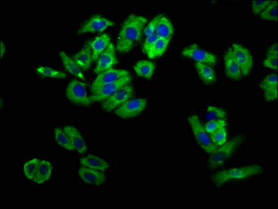 UNC5H2 / UNC5B Antibody - Immunofluorescence staining of HepG2 cells at a dilution of 1:100, counter-stained with DAPI. The cells were fixed in 4% formaldehyde, permeabilized using 0.2% Triton X-100 and blocked in 10% normal Goat Serum. The cells were then incubated with the antibody overnight at 4 °C.The secondary antibody was Alexa Fluor 488-congugated AffiniPure Goat Anti-Rabbit IgG (H+L) .