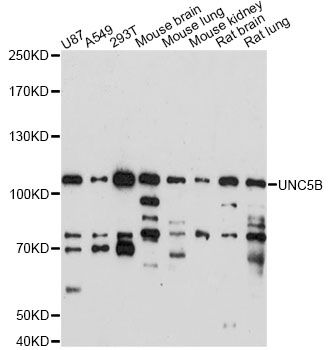 UNC5H2 / UNC5B Antibody - Western blot analysis of extracts of various cell lines, using UNC5B antibody at 1:1000 dilution. The secondary antibody used was an HRP Goat Anti-Rabbit IgG (H+L) at 1:10000 dilution. Lysates were loaded 25ug per lane and 3% nonfat dry milk in TBST was used for blocking. An ECL Kit was used for detection and the exposure time was 90s.