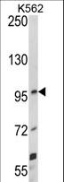 UNC5H3 / UNC5C Antibody - Western blot of UNC5C Antibody in K562 cell line lysates (35 ug/lane). UNC5C (arrow) was detected using the purified antibody.