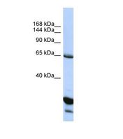 UNC5H3 / UNC5C Antibody - Western blot of Human HepG2. UNC5C antibody dilution 1.0 ug/ml.  This image was taken for the unconjugated form of this product. Other forms have not been tested.