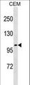 UNC5H3 / UNC5C Antibody - UNC5C Antibody western blot of CEM cell line lysates (35 ug/lane). The UNC5C antibody detected the UNC5C protein (arrow).