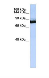 UNC5H3 / UNC5C Antibody - Jurkat cell lysate. Antibody concentration: 1.0 ug/ml. Gel concentration: 6-18%.  This image was taken for the unconjugated form of this product. Other forms have not been tested.