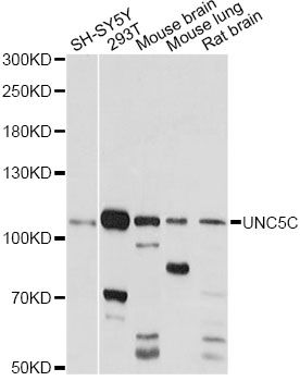 UNC5H3 / UNC5C Antibody - Western blot analysis of extracts of various cell lines, using UNC5C antibody at 1:1000 dilution. The secondary antibody used was an HRP Goat Anti-Rabbit IgG (H+L) at 1:10000 dilution. Lysates were loaded 25ug per lane and 3% nonfat dry milk in TBST was used for blocking. An ECL Kit was used for detection and the exposure time was 5s.