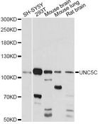 UNC5H3 / UNC5C Antibody - Western blot analysis of extracts of various cell lines, using UNC5C antibody at 1:1000 dilution. The secondary antibody used was an HRP Goat Anti-Rabbit IgG (H+L) at 1:10000 dilution. Lysates were loaded 25ug per lane and 3% nonfat dry milk in TBST was used for blocking. An ECL Kit was used for detection and the exposure time was 5s.