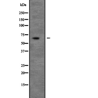 UNC5H3 / UNC5C Antibody - Western blot analysis of UNC5C expression in 293T whole cells lysate. The lane on the left is treated with the antigen-specific peptide.