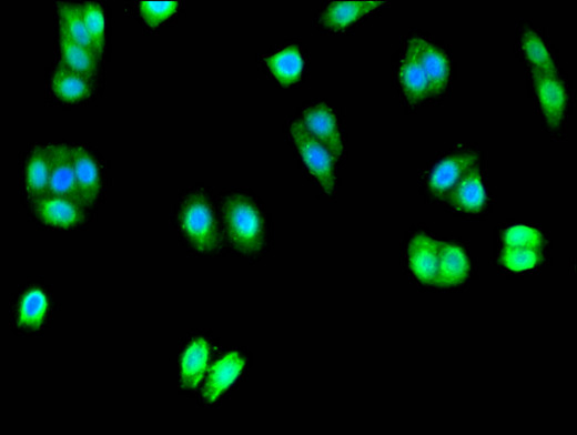 UNC80 Antibody - Immunofluorescent analysis of HepG2 cells using UNC80 Antibody at a dilution of 1:100 and Alexa Fluor 488-congugated AffiniPure Goat Anti-Rabbit IgG(H+L)