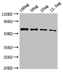 UNC80 Antibody - Western Blot Positive WB detected in Recombinant protein All lanes: UNC80 antibody at 3.5µg/ml Secondary Goat polyclonal to rabbit IgG at 1/50000 dilution Predicted band size: 59 kDa Observed band size: 59 kDa