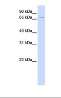 UNC84B / SUN2 Antibody - MCF7 cell lysate. Antibody concentration: 1.0 ug/ml. Gel concentration: 12%.  This image was taken for the unconjugated form of this product. Other forms have not been tested.