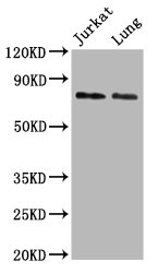 UNC84B / SUN2 Antibody - Western Blot Positive WB detected in: Jurkat whole cell lysate, Rat lung tissue All Lanes: SUN2 antibody at 4.5µg/ml Secondary Goat polyclonal to rabbit IgG at 1/50000 dilution Predicted band size: 81, 83, 80 KDa Observed band size: 81 KDa