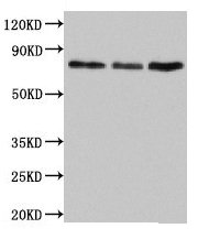 UNC84B / SUN2 Antibody - Western Blot Positive WB detected in: Jurkat whole cell lysate, Rat lung tissue, Mouse liver tissue All lanes: SUN2 antibody at 4.5µg/ml Secondary Goat polyclonal to rabbit IgG at 1/50000 dilution Predicted band size: 81, 83, 80 kDa Observed band size: 81 kDa