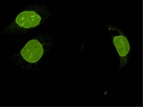 UNC84B / SUN2 Antibody