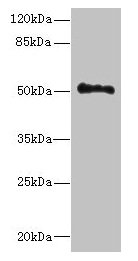 UNC93A Antibody - Western blot All lanes: UNC93A antibody at 14µg/ml + Hela whole cell lysate Secondary Goat polyclonal to rabbit IgG at 1/10000 dilution Predicted band size: 51, 46 kDa Observed band size: 51 kDa