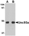 UNC93A Antibody - Western blot of Unc93a in HeLa cell lysate with Unc93a antibody at (A) 0.5 and (B) 1 ug/ml.