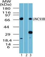 UNC93B / UNC93B1 Antibody - Western blot of UNC93B in human spleen lysate in the 1) absence and 2) presence of immunizing peptide, and 3) mouse spleen lysate, using antibody at 4 ug/ml.