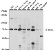 UNC93B / UNC93B1 Antibody - Western blot analysis of extracts of various cell lines, using UNC93B1 antibody at 1:1000 dilution. The secondary antibody used was an HRP Goat Anti-Rabbit IgG (H+L) at 1:10000 dilution. Lysates were loaded 25ug per lane and 3% nonfat dry milk in TBST was used for blocking. An ECL Kit was used for detection and the exposure time was 15S.