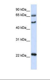 UNCX Antibody - 293T cell lysate. Antibody concentration: 1.0 ug/ml. Gel concentration: 12%.  This image was taken for the unconjugated form of this product. Other forms have not been tested.