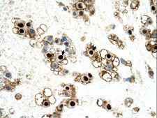 UNCX Antibody - UNCX antibody UNCX Antibody was used in IHC to stain formalin-fixed, paraffin-embedded human placenta.  This image was taken for the unconjugated form of this product. Other forms have not been tested.