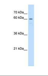 UNCX Antibody - Jurkat cell lysate. Antibody concentration: 1.0 ug/ml. Gel concentration: 12%.  This image was taken for the unconjugated form of this product. Other forms have not been tested.
