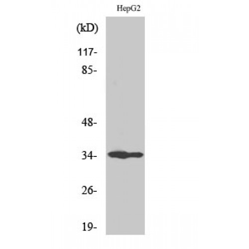 UNG / Uracil DNA Glycosylase Antibody - Western blot of UDG antibody